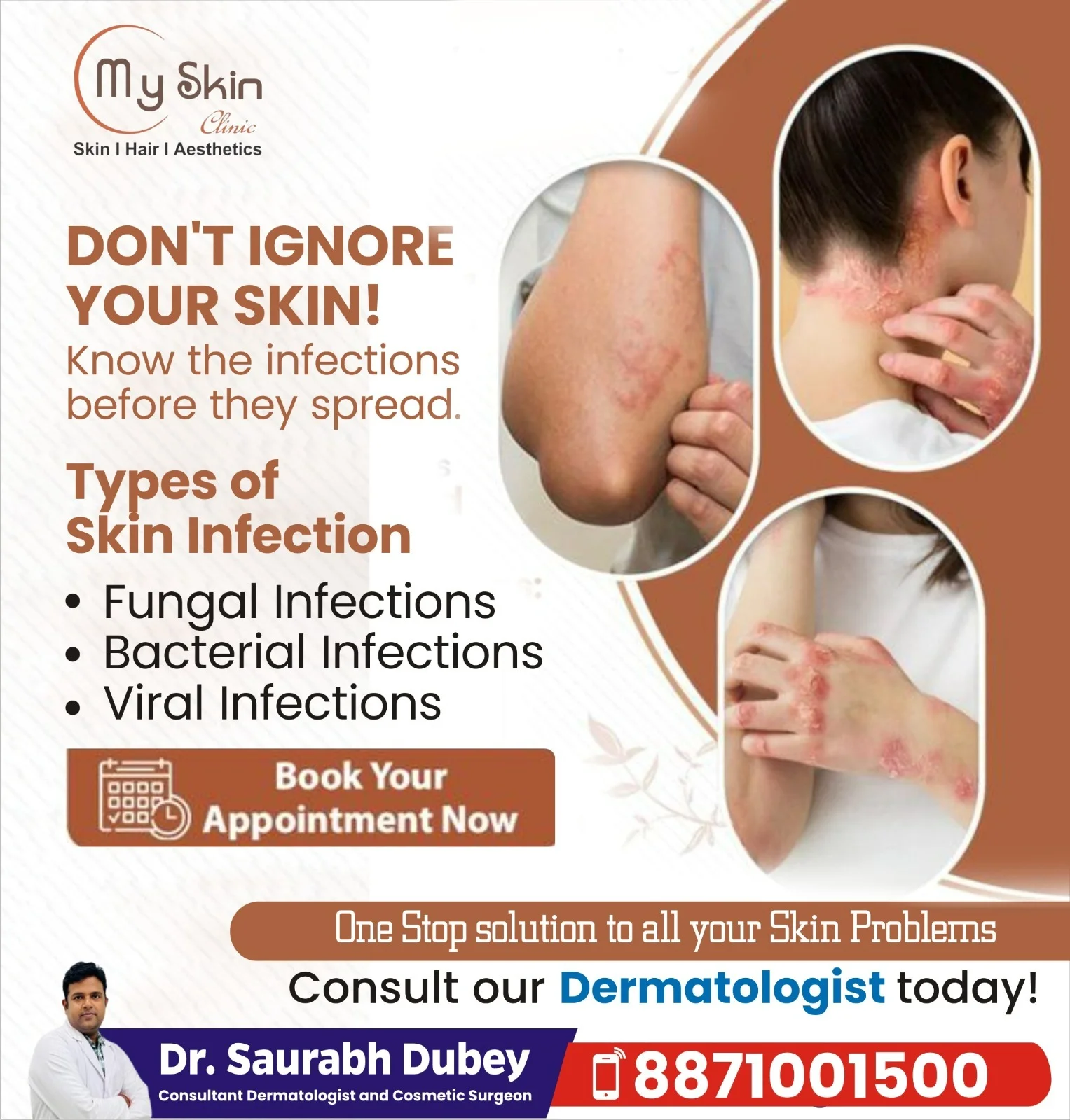 Skin Infection Treatment in Indore